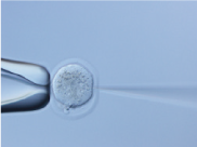 In vitro fertilization of mice