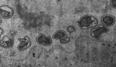 図2. 核内共生細菌の透過型電子顕微鏡像。写真で核膜の内側にあるのが、ベルコミクロビア門細菌である。分裂中のものも見られる。